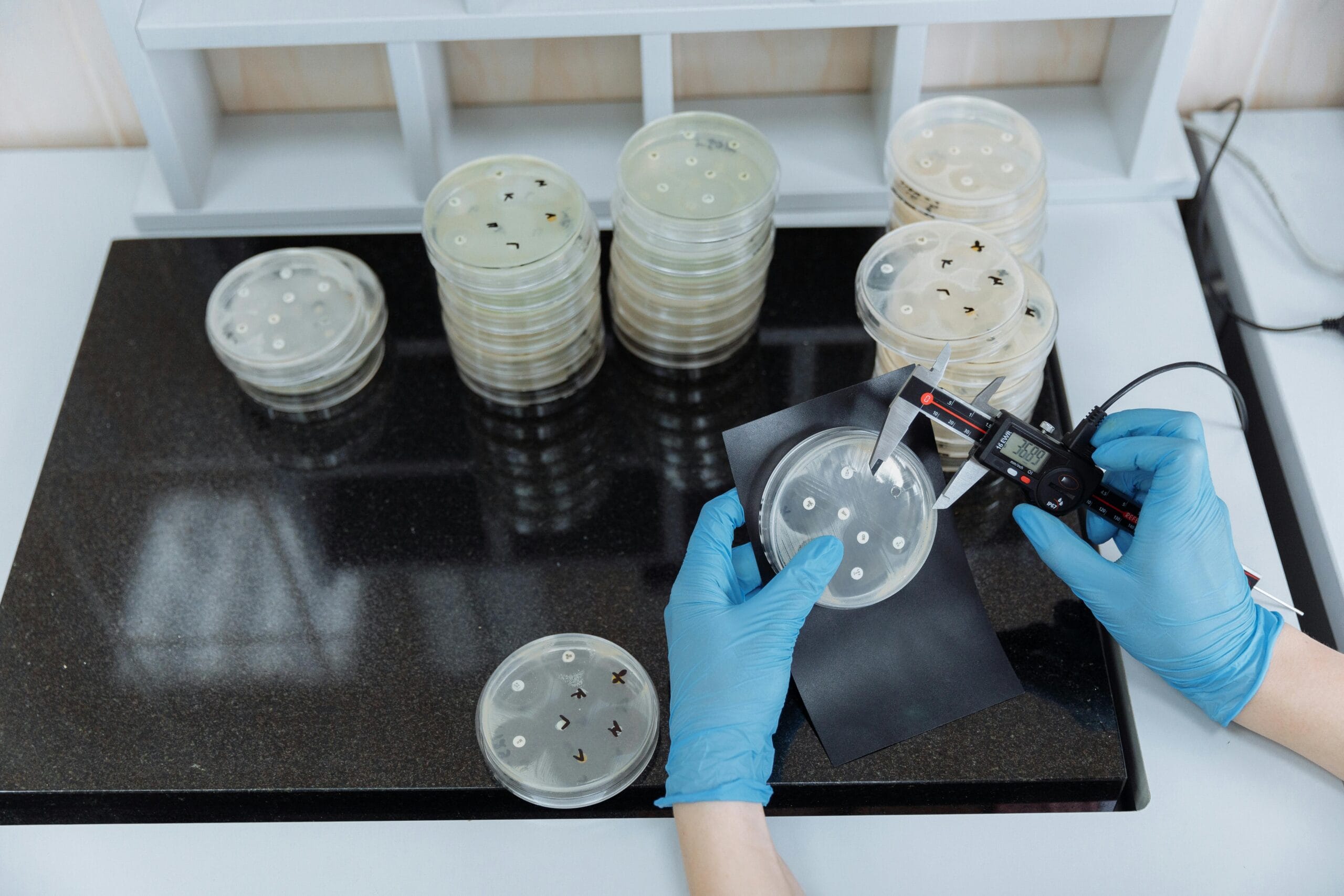 Superbug laboratory test