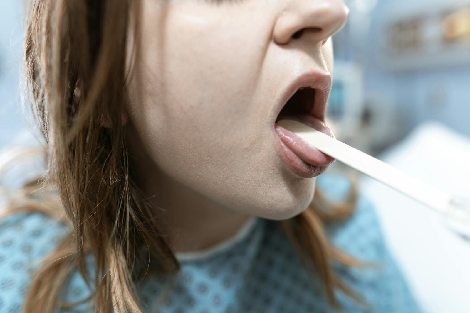 Close-up of a woman having her throat examined in a medical setting with a tongue depressor. Strep Throat.