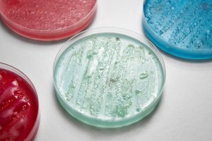 Detection of Harmful Microorganisms through Microbiological Contamination Testing