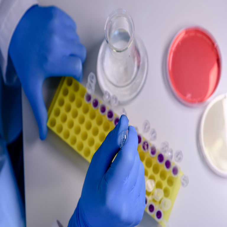 2 Antimicrobial Testing Methods: Broth Macrodillution vs. Microdilution, Which is More Accurate?