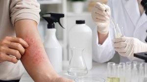 Skin Irritation from Insecticides: Why Is Safety Testing Important?