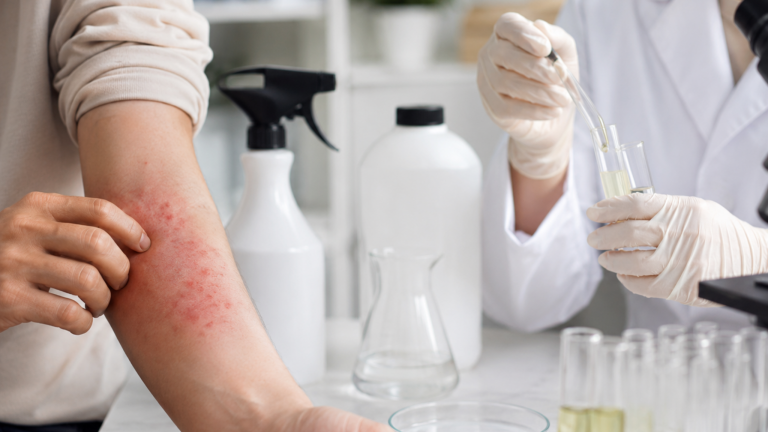 Skin Irritation from Insecticides: Why Is Safety Testing Important?